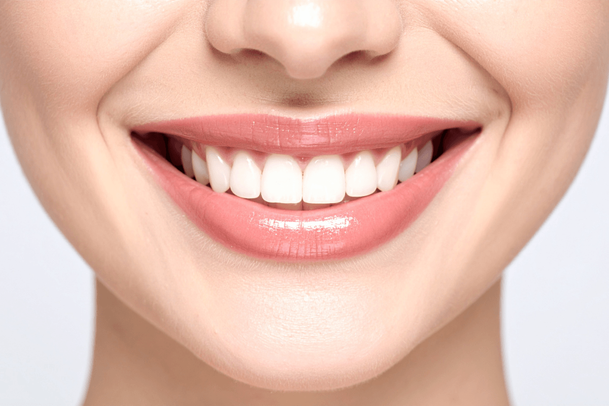Estética Dental y Facial