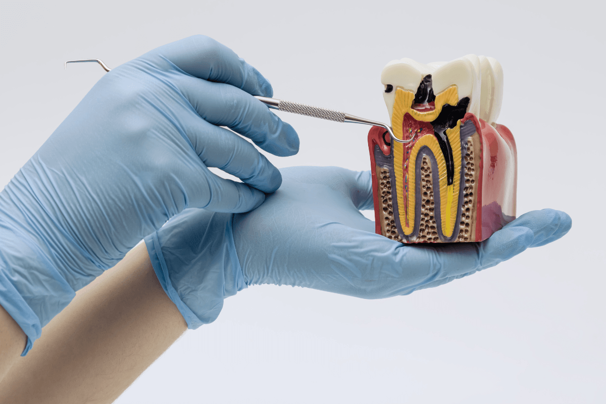 Endodoncia y Periodoncia